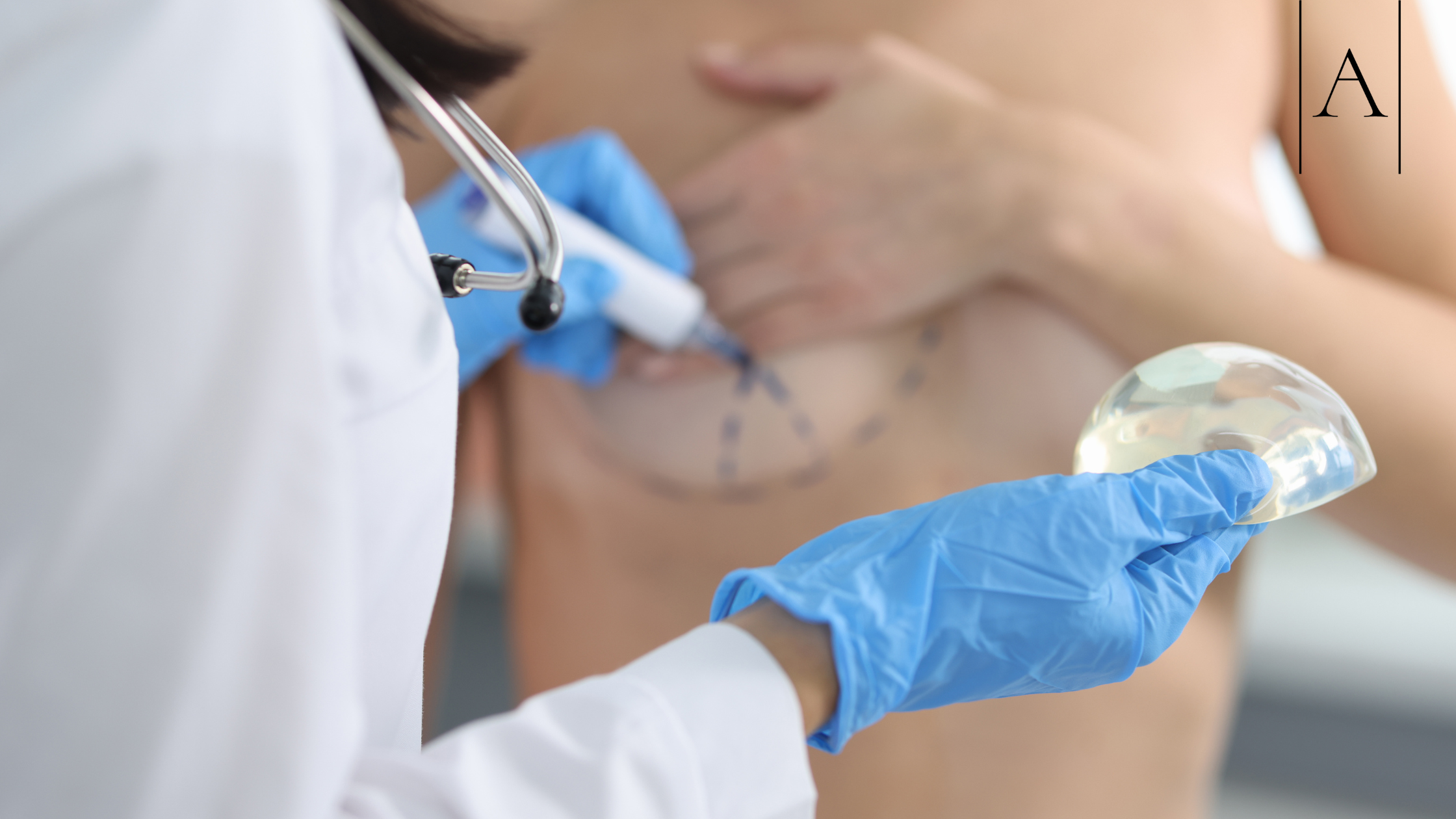 Breast Lift with Implants: The Perfect Combination? 3 36a5fa4f00444b2295d8e15f09f171f2