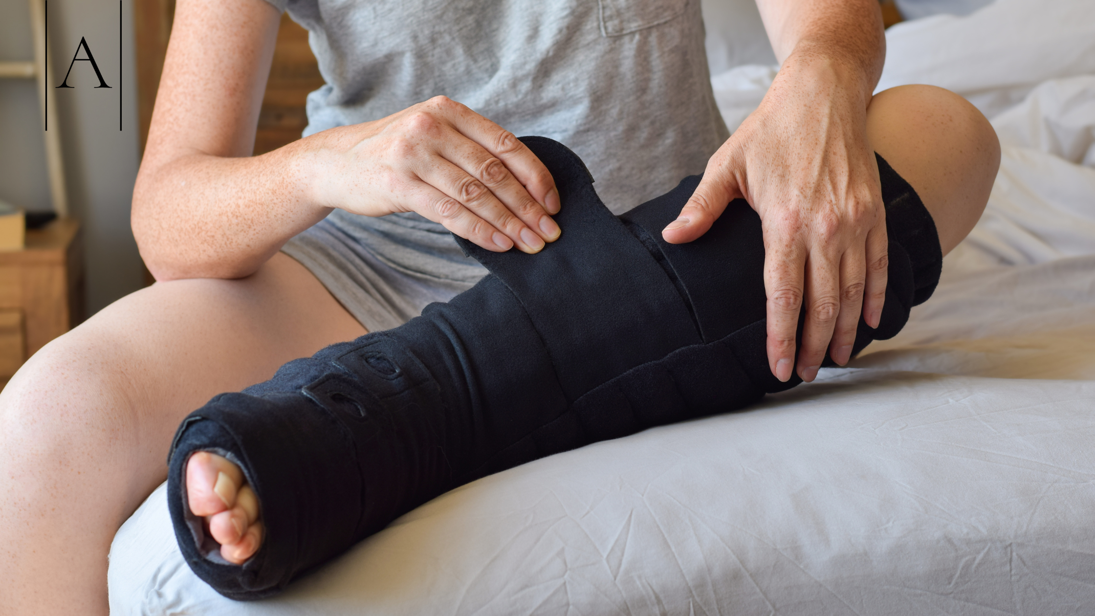 How Liposuction Can Improve Mobility for Lymphedema Patients 2 Liposuction for Lymphedema: How It Works
