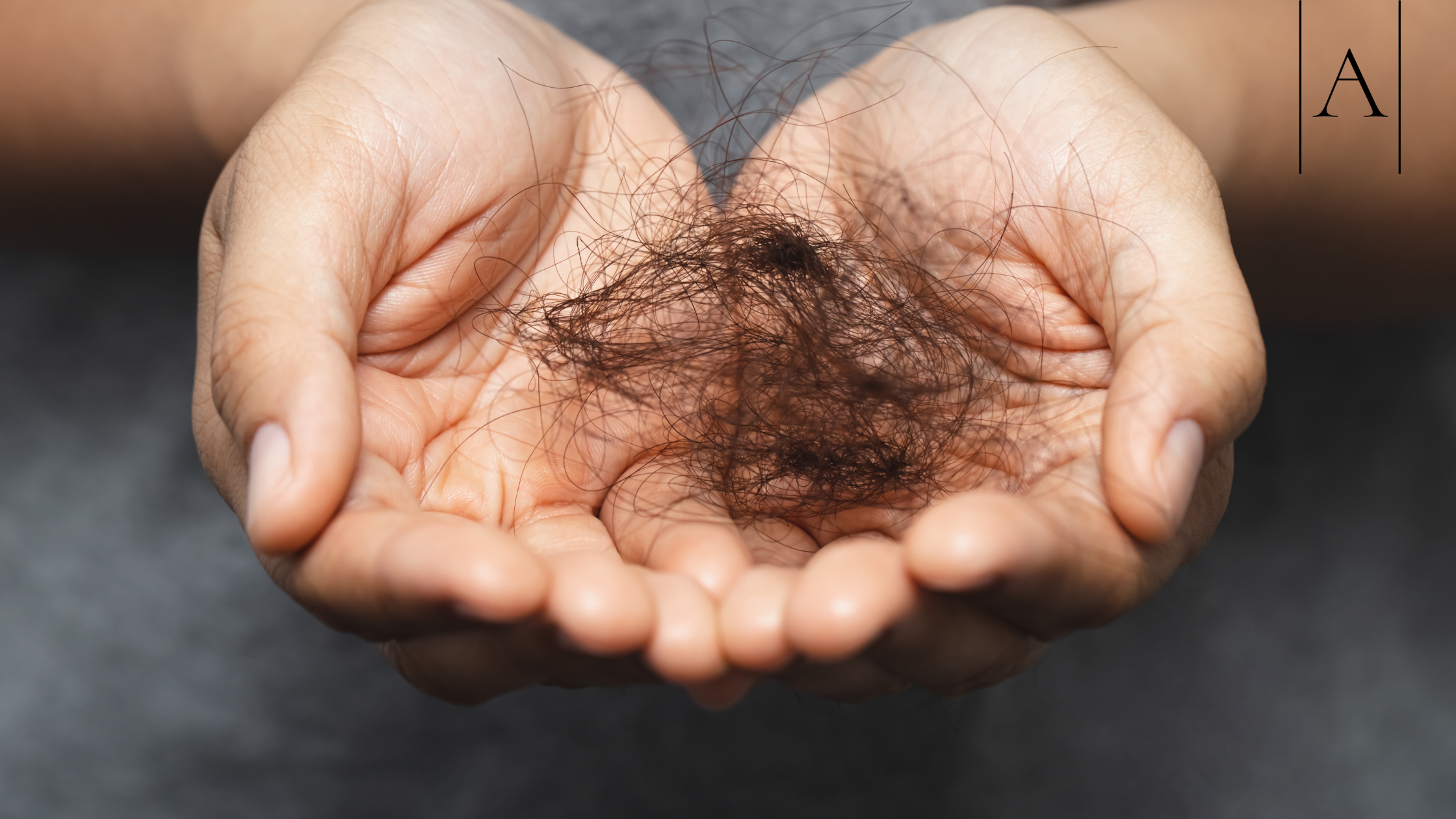 Weight Loss Jabs and Hair Loss: What's Really Happening? 1 5be8d71f18d044ea86718d81d5e6651b