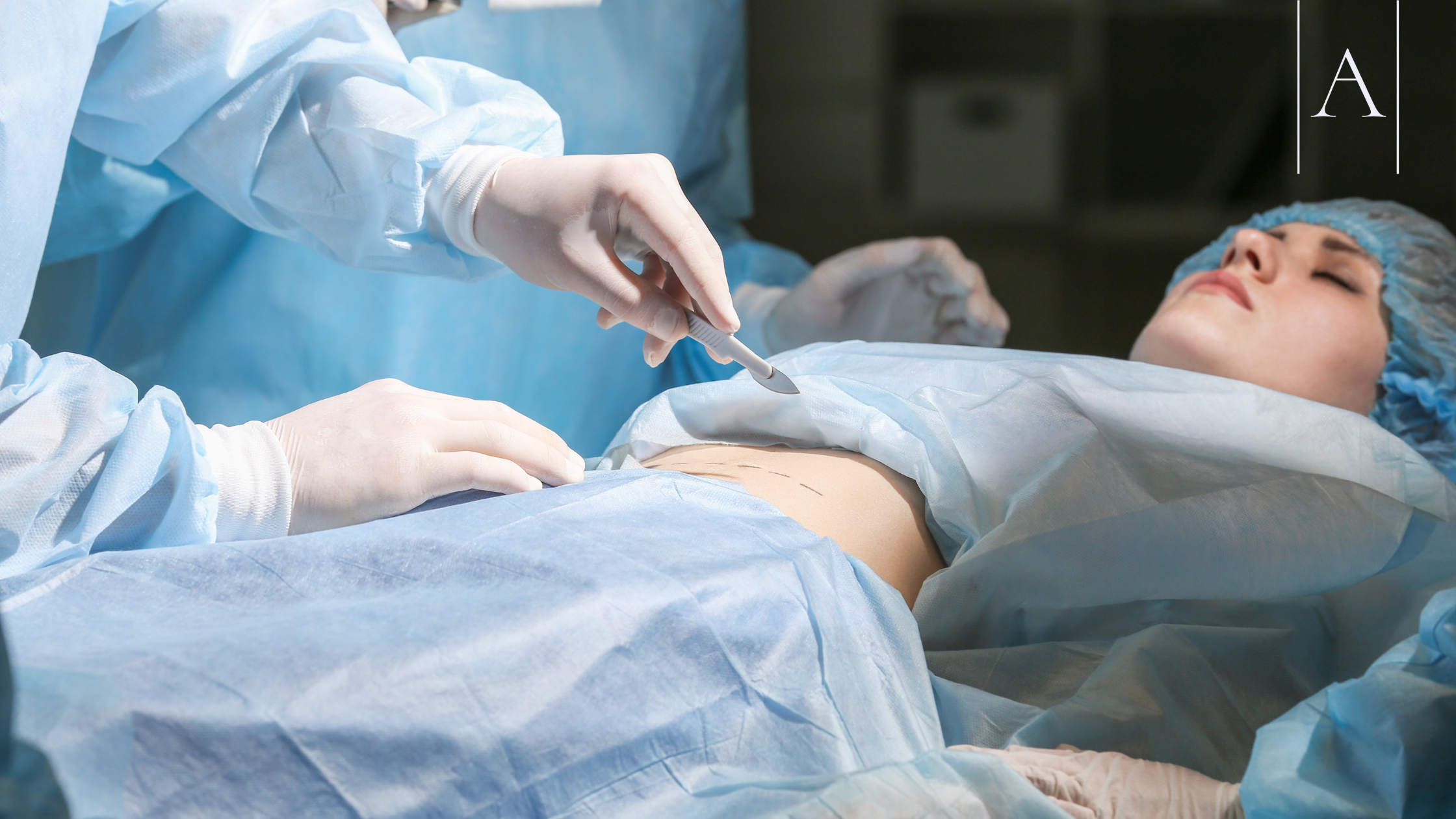 Combining Abdominoplasty and Hernia Repair: Benefits, Risks & Recovery Explained 8 7f645c1c68704394ab7855244e211af4