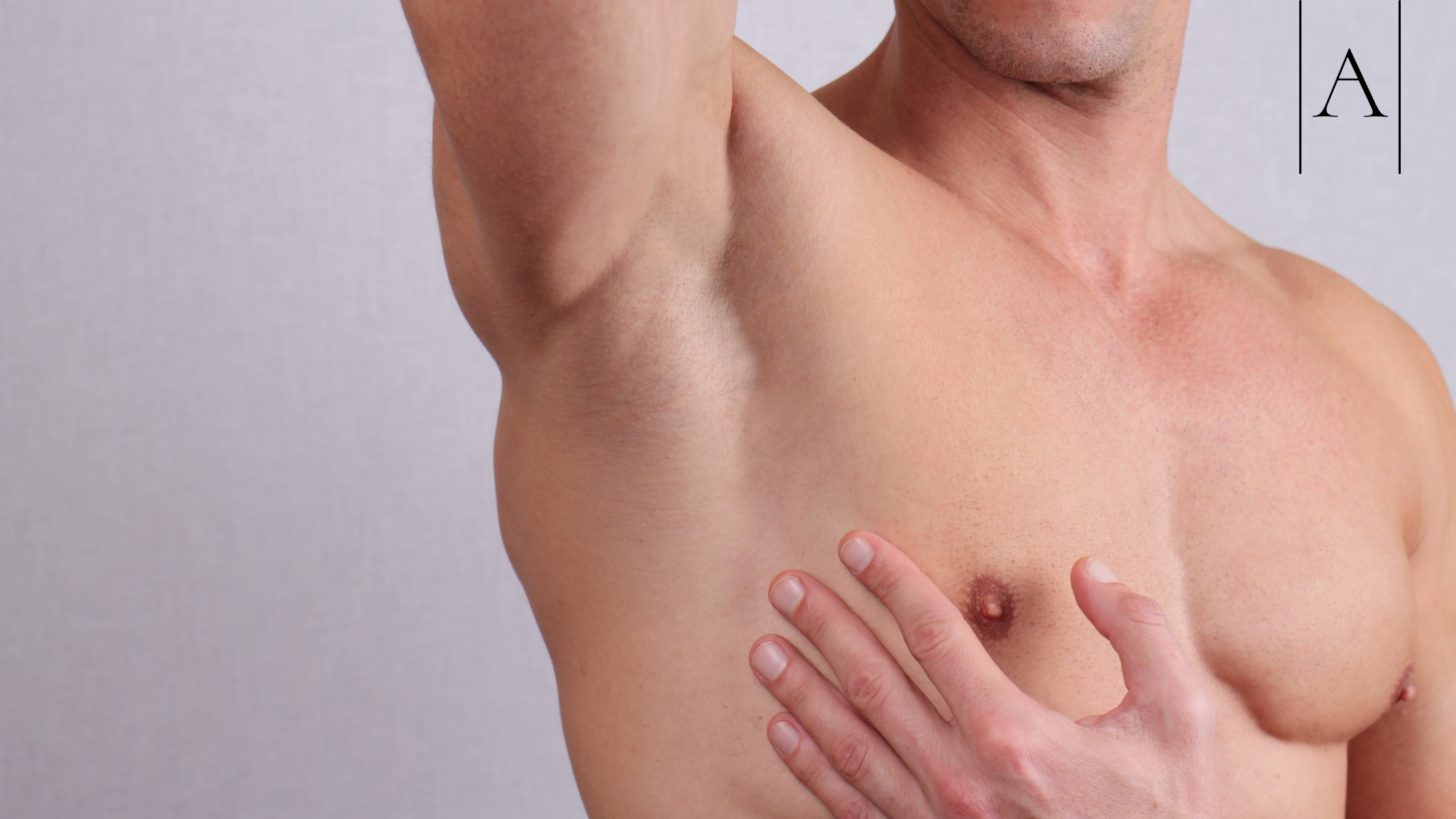 How to Prepare for Gynecomastia Surgery: A Step-by-Step Checklist 5 bda9ce5a079941ae8a82c3c177d3a9ef