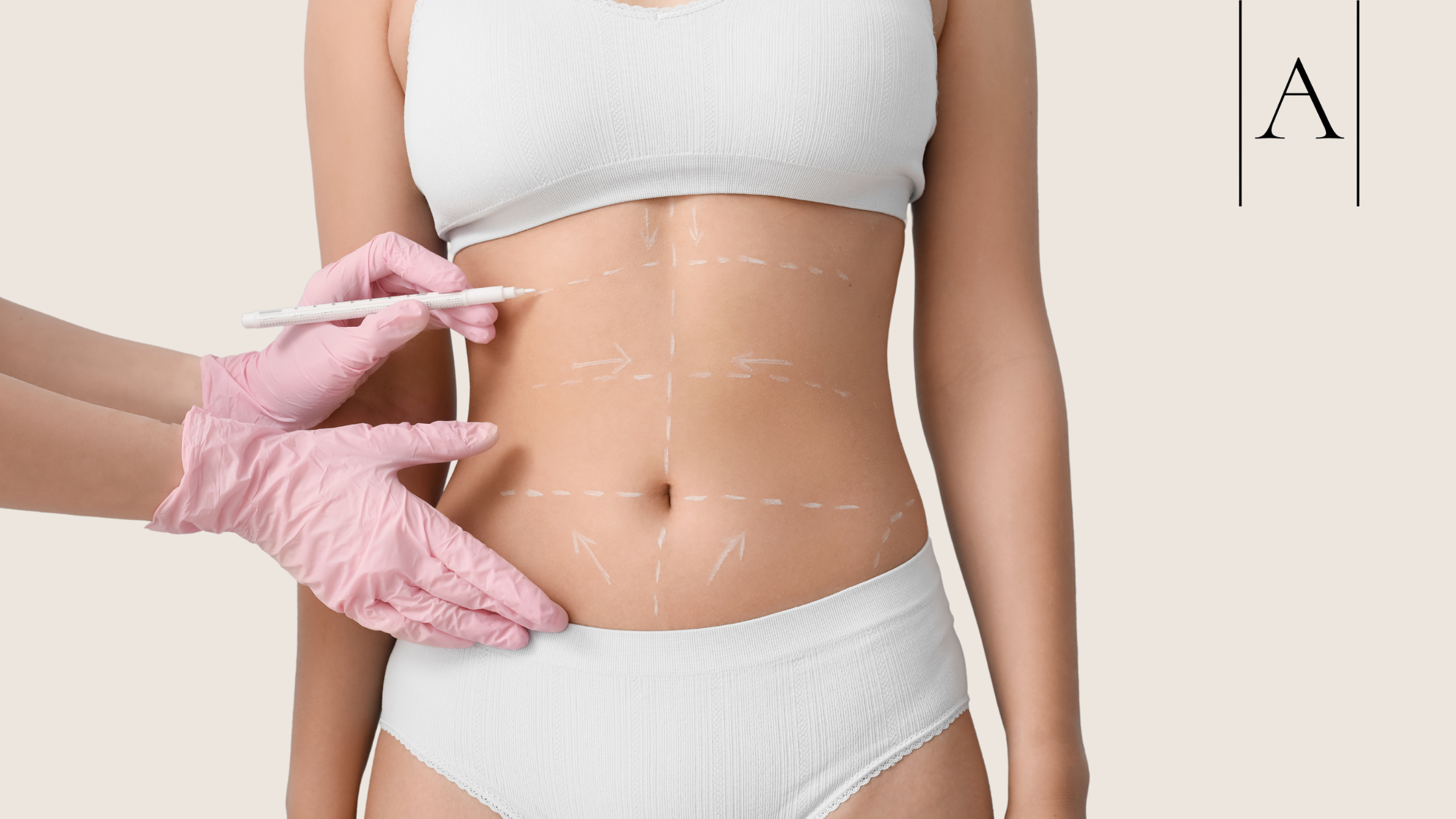 Transform Your Confidence with a Mommy Makeover 2 cccc43abccb0422a9de63916f6bec69a