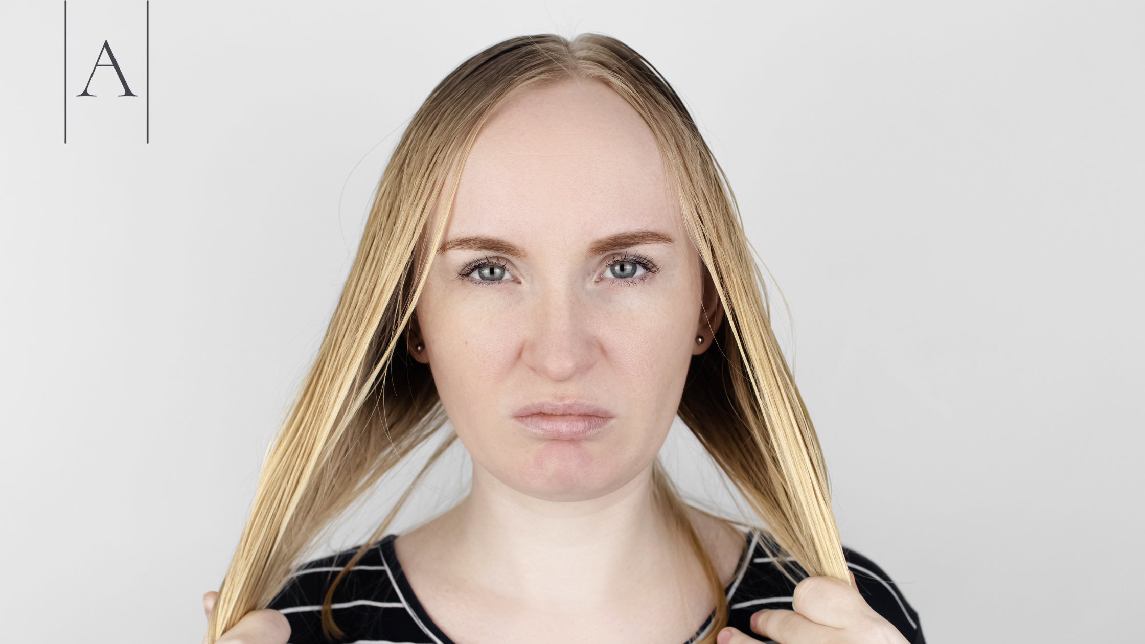 Hair Transplant for Women