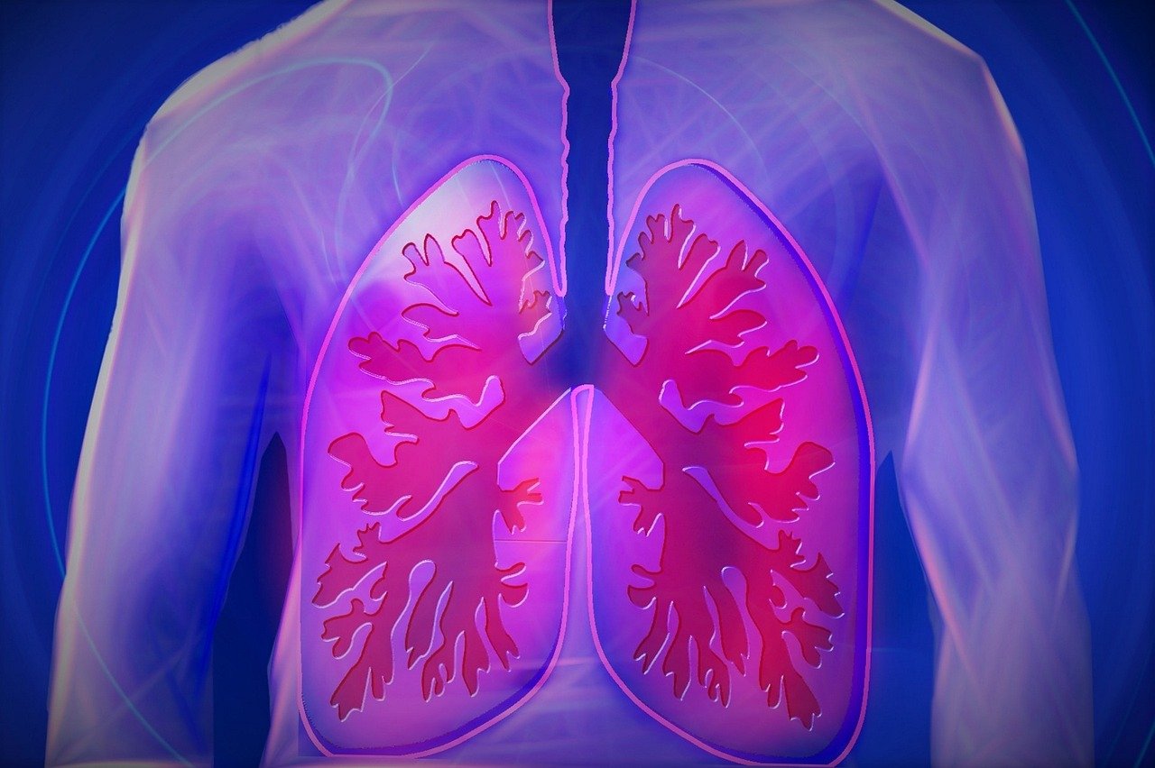 High-Dose Corticosteroids May Undermine Immunotherapy Success in Lung Cancer Patients
