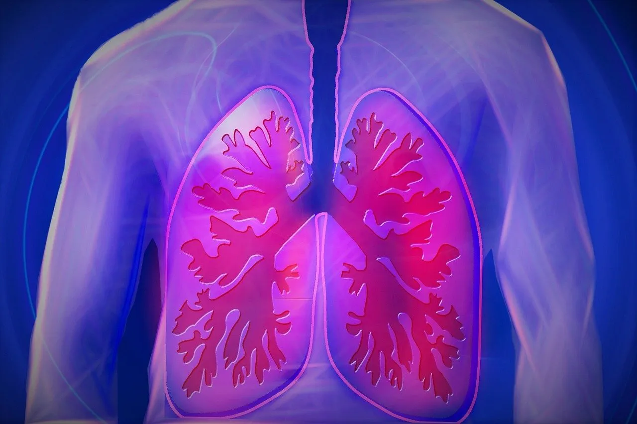 High-Dose Corticosteroids May Undermine Immunotherapy Success in Lung Cancer Patients