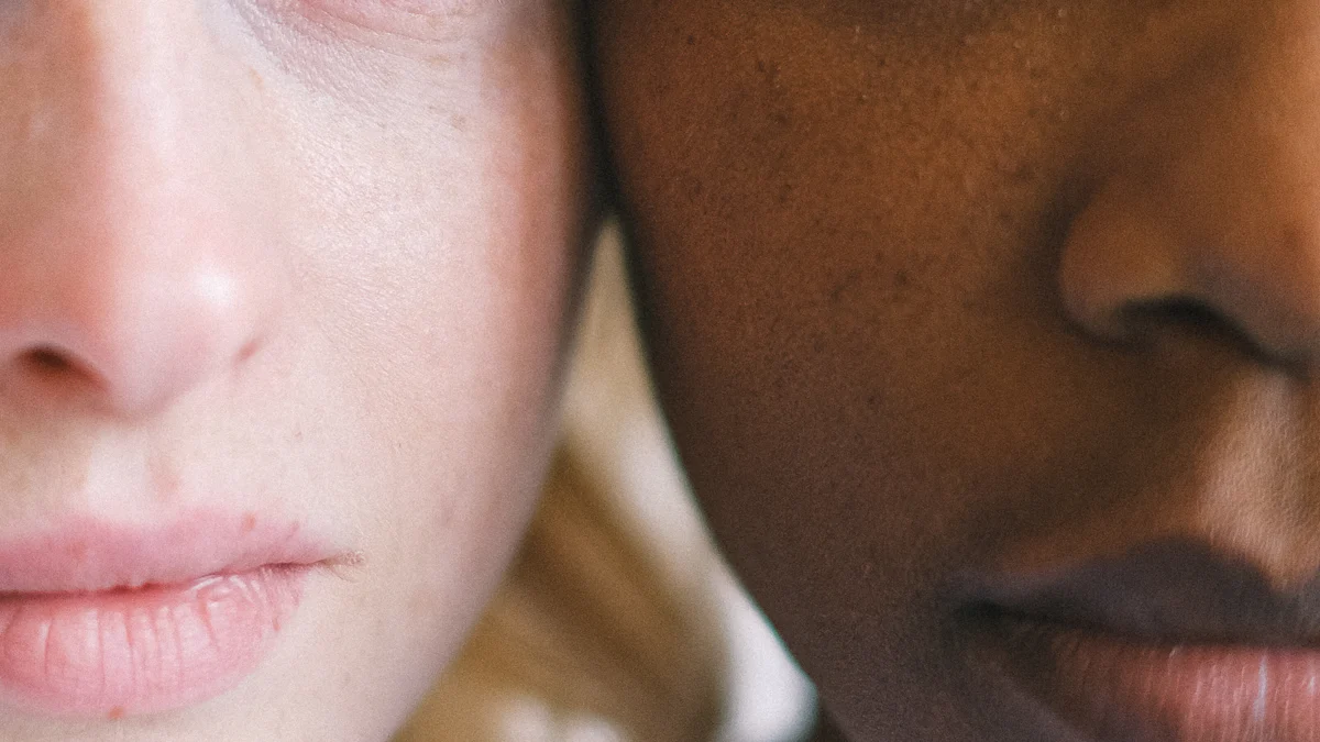 Understanding Skin Tones