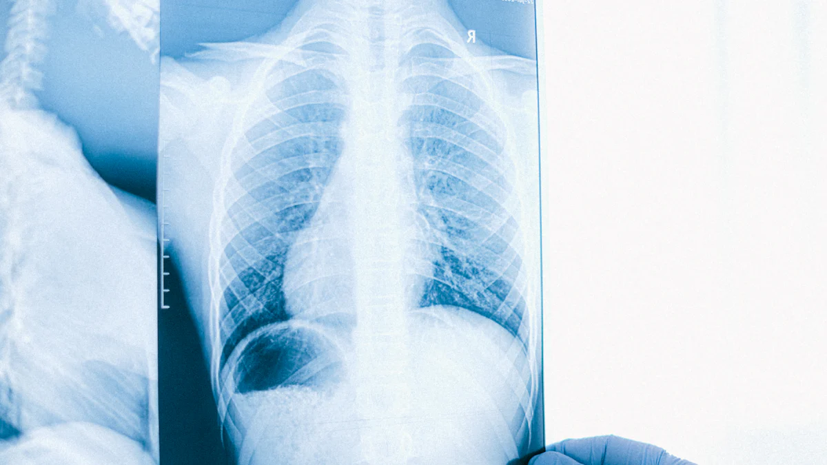 EBCT Provides Unmatched Accuracy in Coronary Artery Disease Diagnosis
