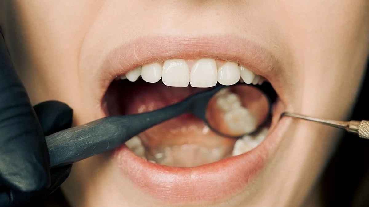 Top 10 Common Causes of Teeth Pain