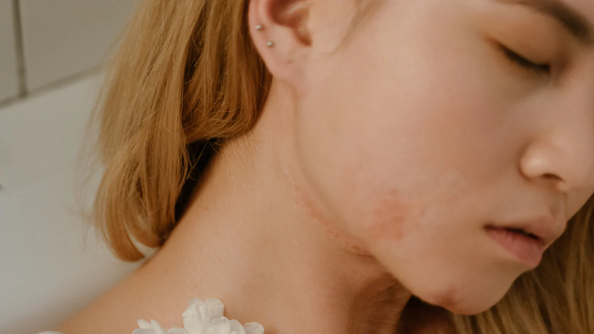 Hoe Gezichtsyoga Je Huid Kan Transformeren