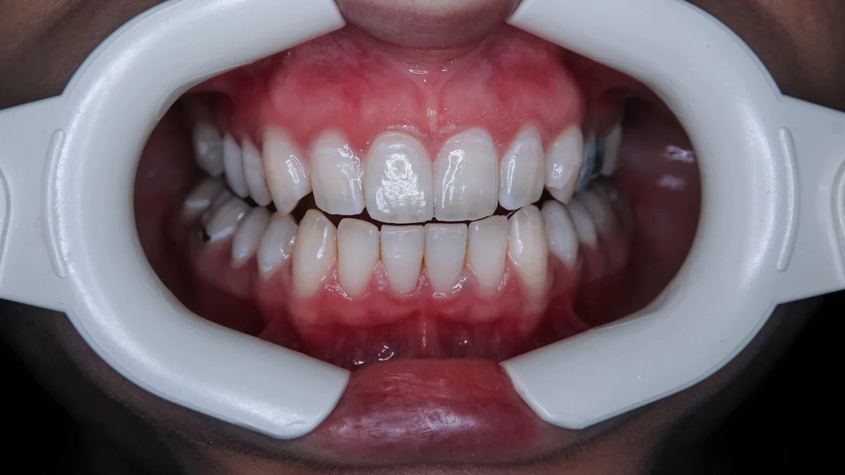 The Key Benefits of Using ProvaDent for Teeth