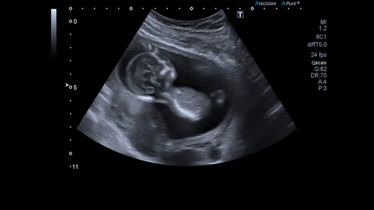 Healthy Pregnancy Week by Week Guide