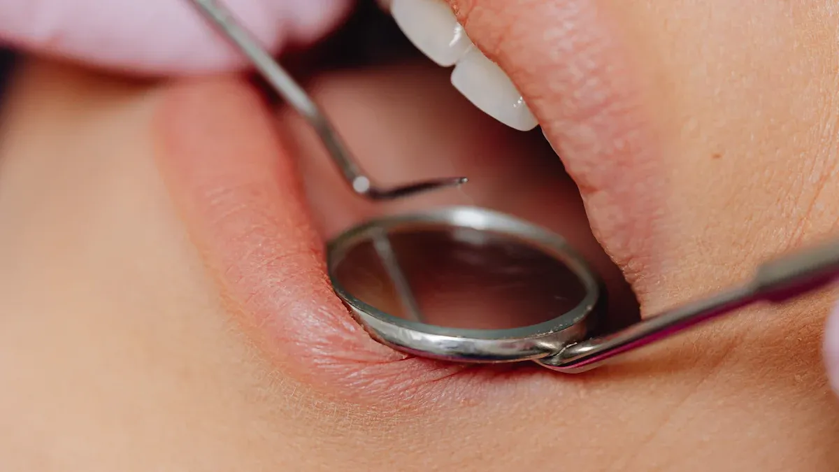 Prevenirea cariilor dentare