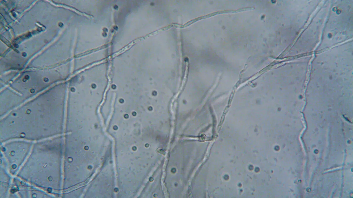 Real-World Applications of Mold Flow Analysis