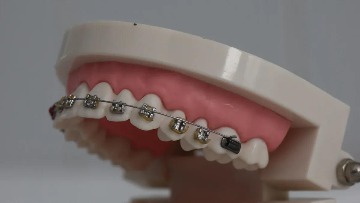 Unique Features of Each Orthodontic Brackets Manufacturer