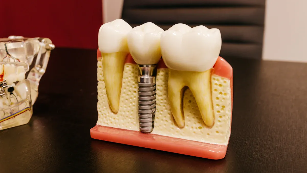 Superior Properties of Ceramic Components Over Metals