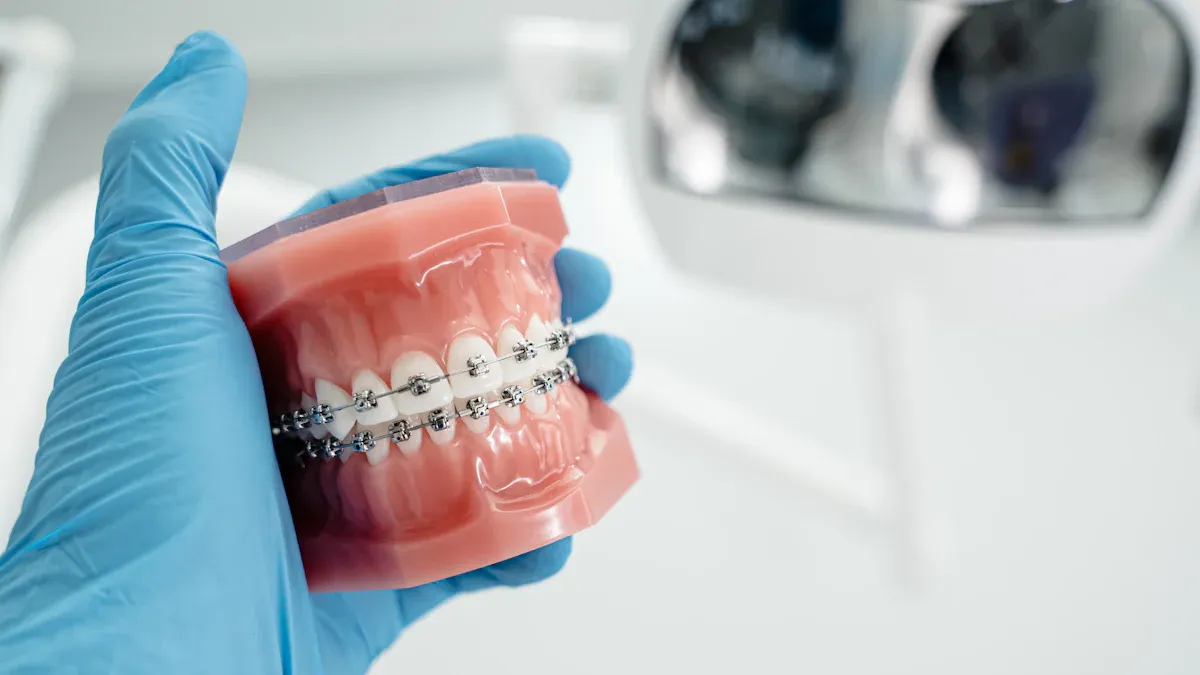 Why Metal Self-Ligating Brackets Remain the First Choice for Complex Cases