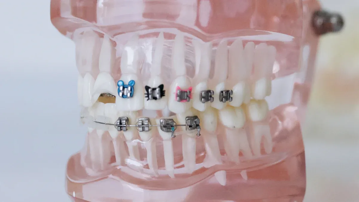 Technological advancements in orthodontic products
