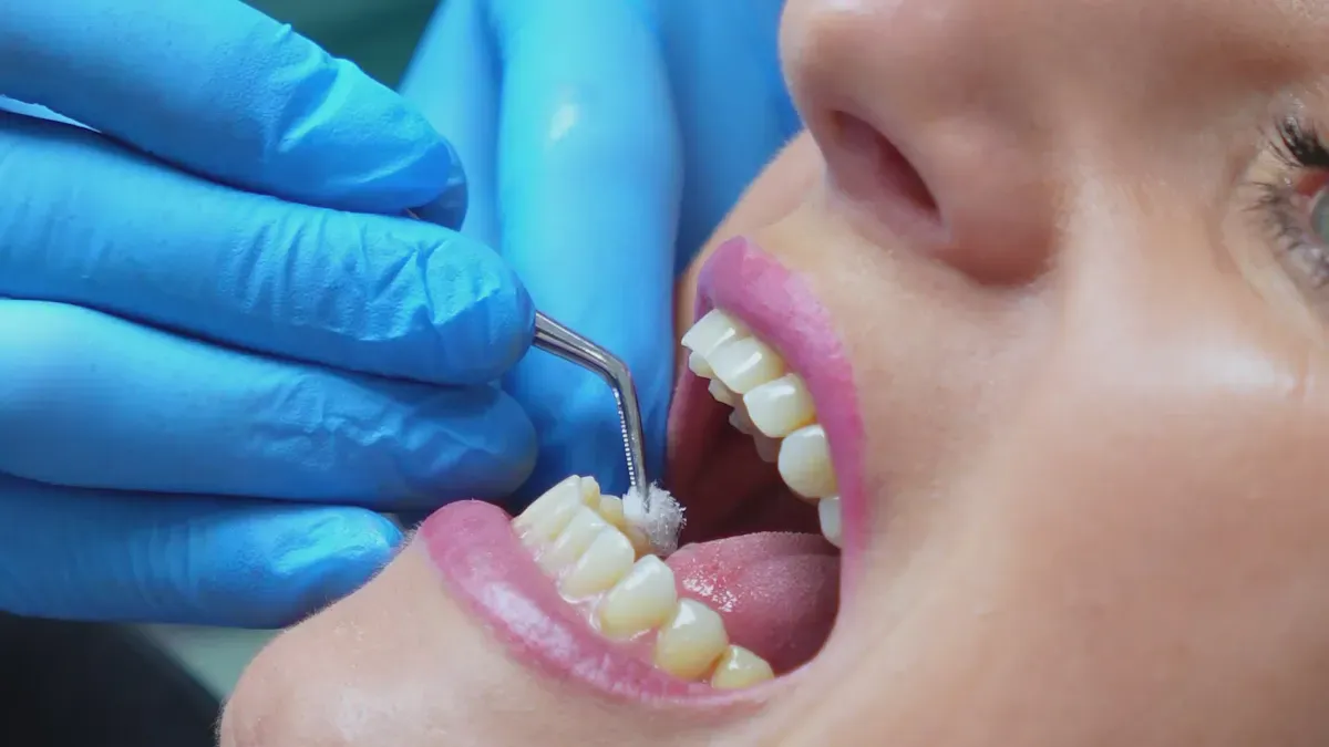 How Orthodontic Brackets Move Teeth