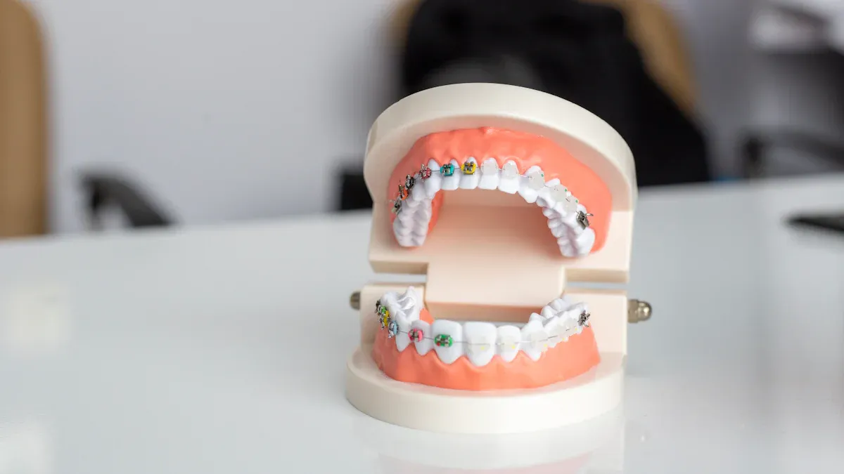 Self-Ligating vs. Traditional Brackets: A Direct Comparison