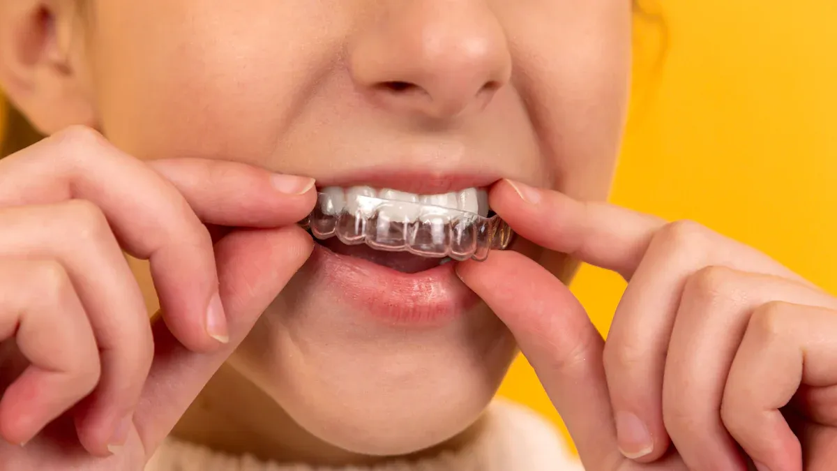 Orthodontic Self-Ligating Brackets vs. Traditional Brackets