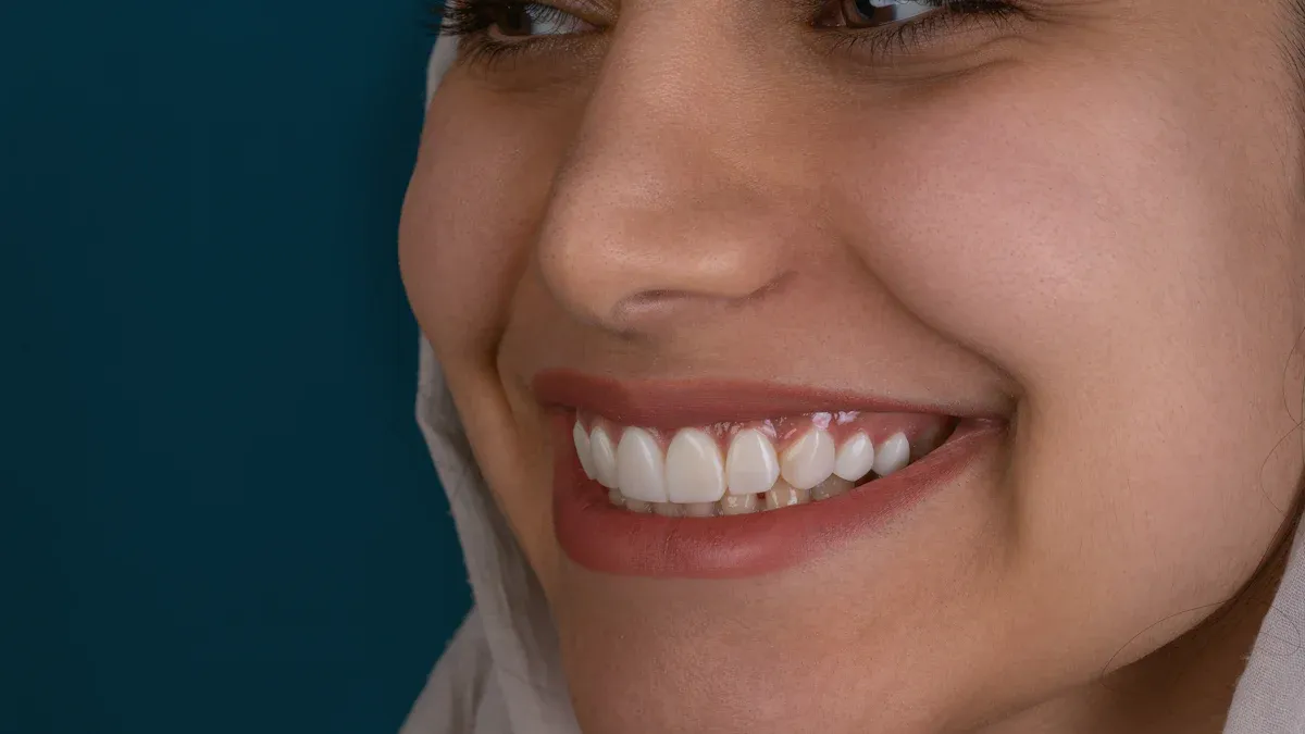 Why are ceramic self-ligating brackets the top choice for aesthetic orthodontics?