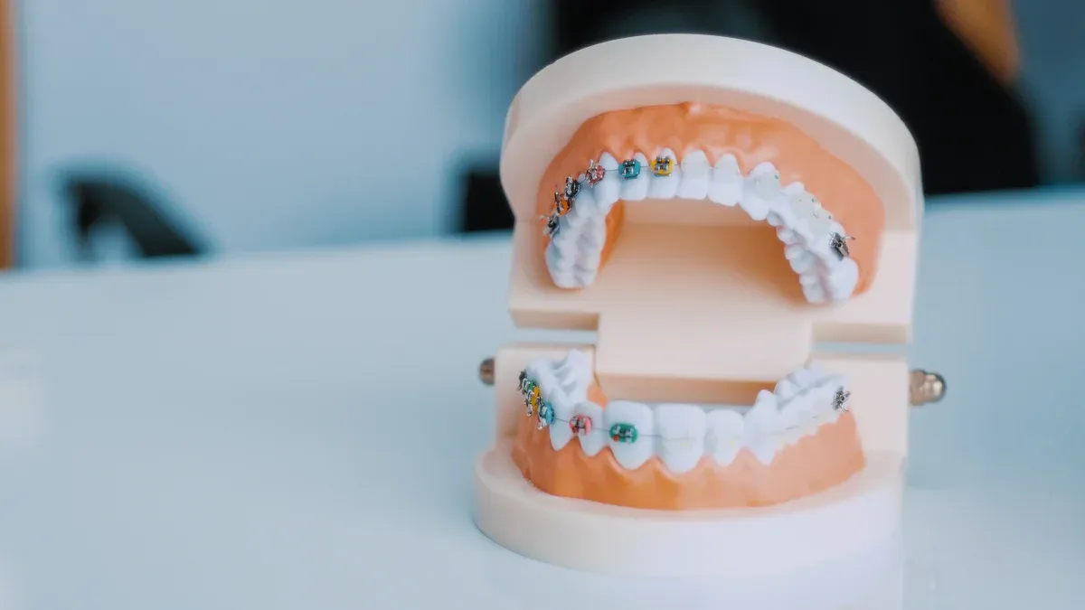What innovations define the best orthodontic brackets for professionals today?