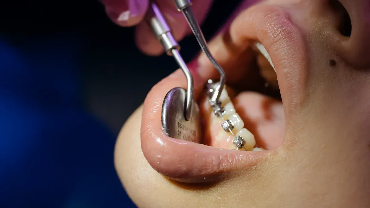 3M Unitek: Pioneering Precision Dental Orthodontic Instruments