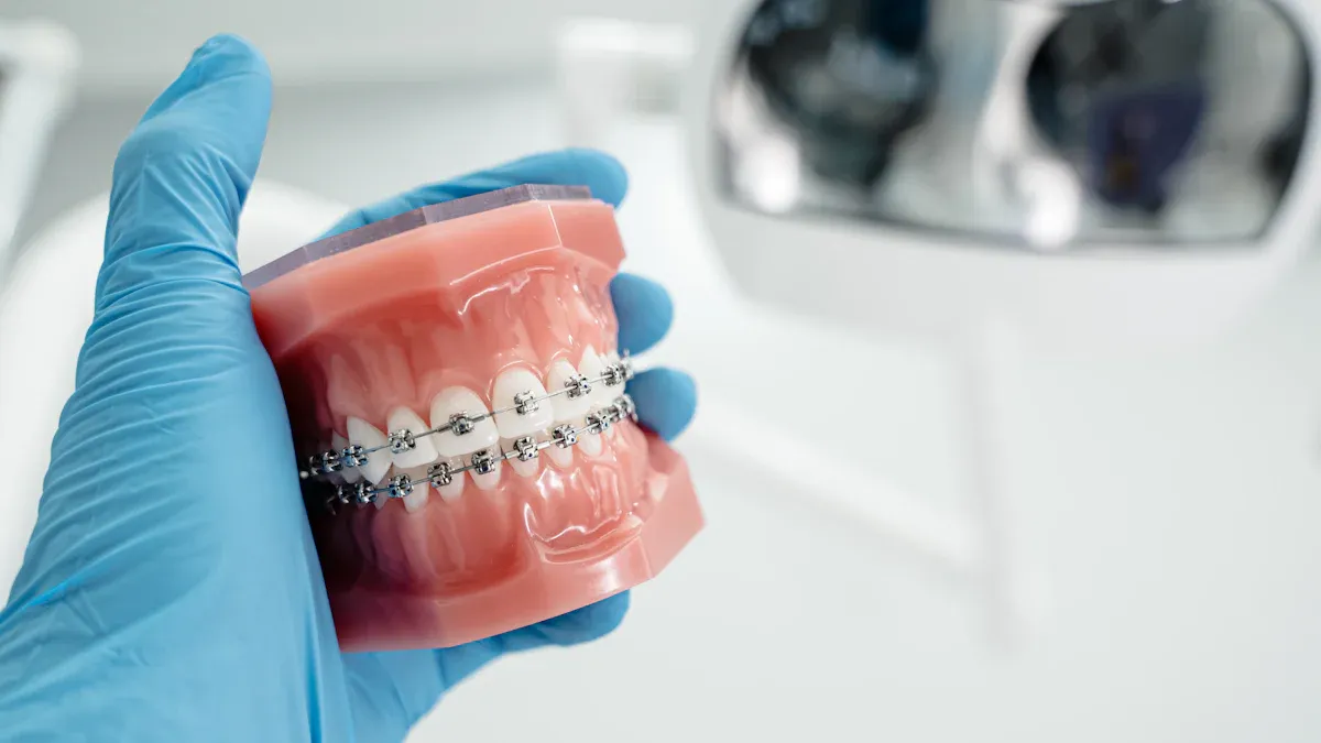Orthodontic Brackets Compared Metal Ceramic and Self-Ligating