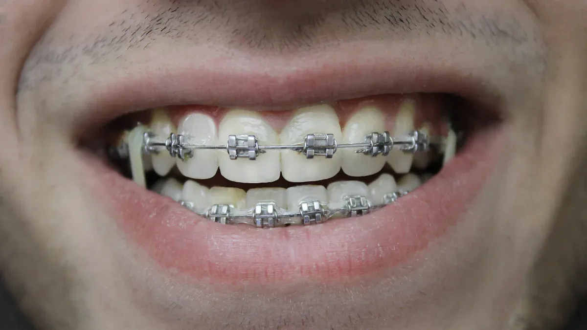 Prioritizing Patient Satisfaction with Orthodontic Brackets