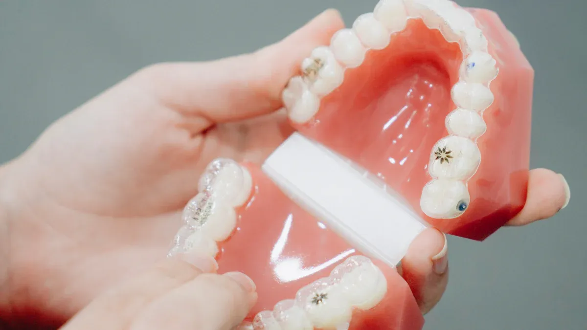 Understanding Self-Ligating Orthodontic Brackets