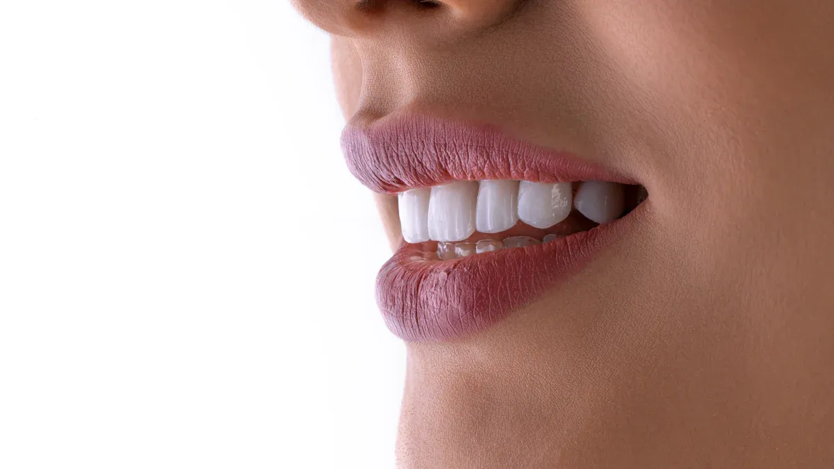 Your Guide to Orthodontic Self Ligating Braces and Their Advantages
