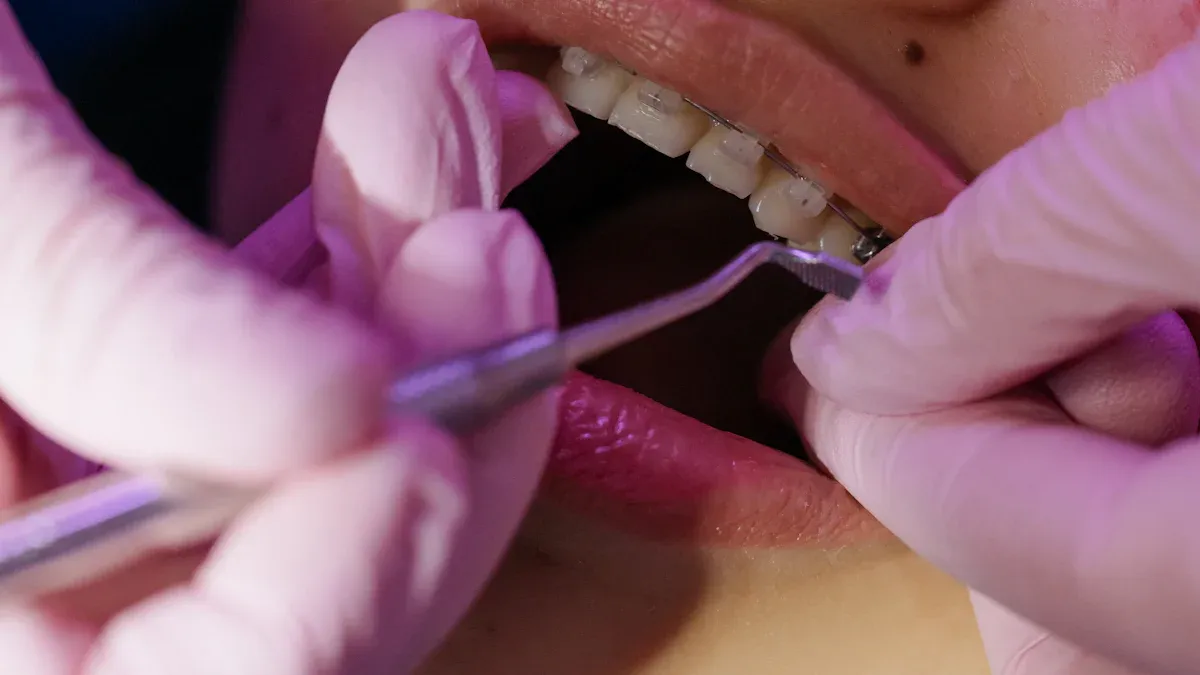 Importance of Following Instructions with Orthodontic Elastics