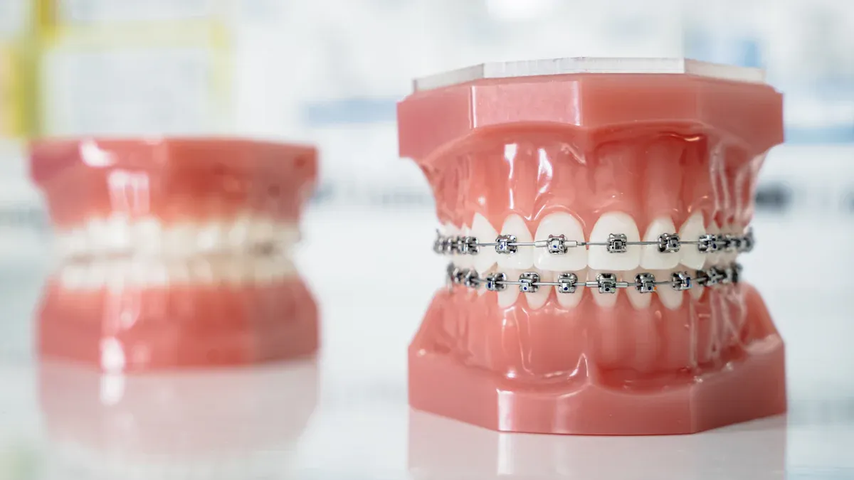 Can Ceramic Self-Ligating Brackets Balance Aesthetics and Treatment Efficiency?