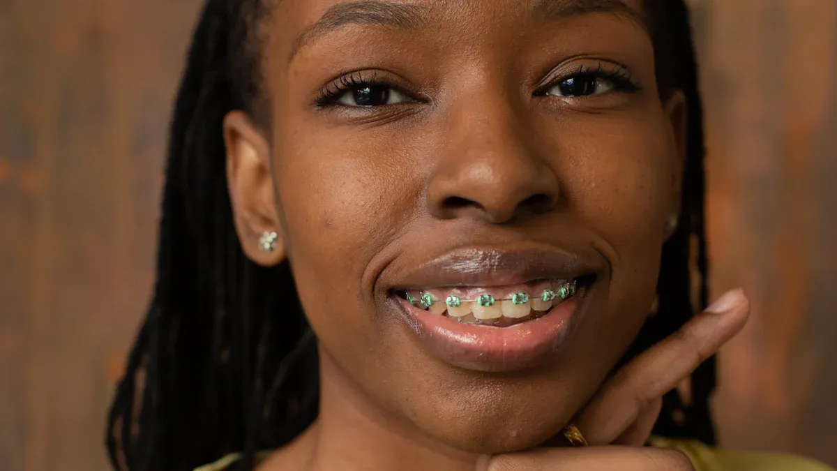 Future Trends in Chinese Metal Self-Ligating Brackets