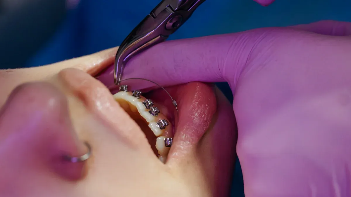 Understanding Archwires: Materials, Uses, and How They Affect Treatment Outcomes