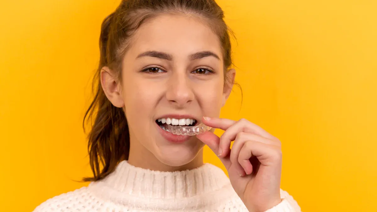 Improved Oral Hygiene with Orthodontic Self-Ligating Brackets