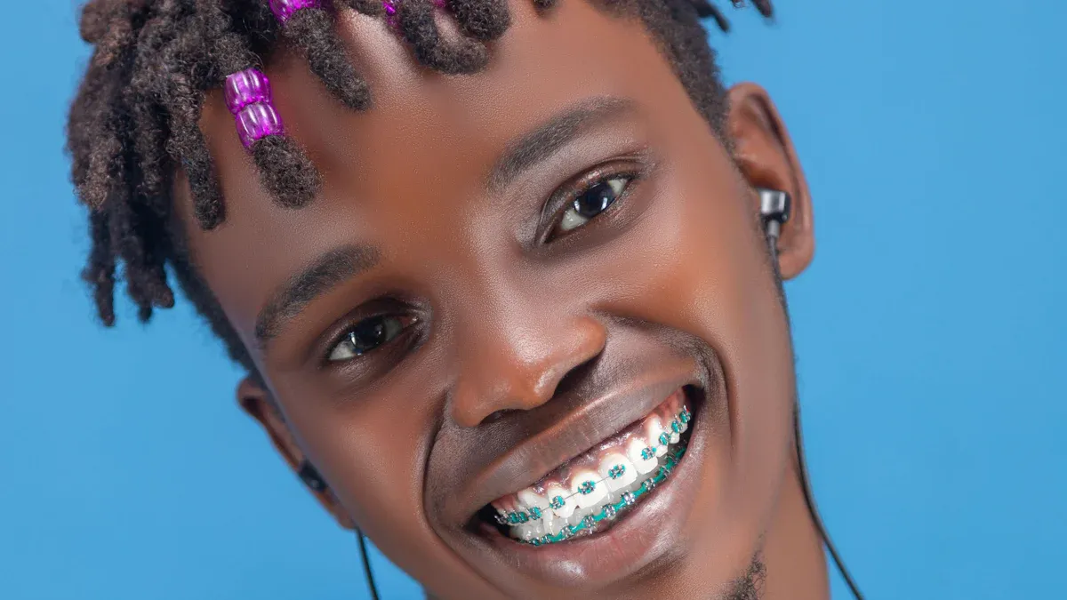 Real-World Impact: Transforming Orthodontic Practices with Chinese Self-Ligating Brackets