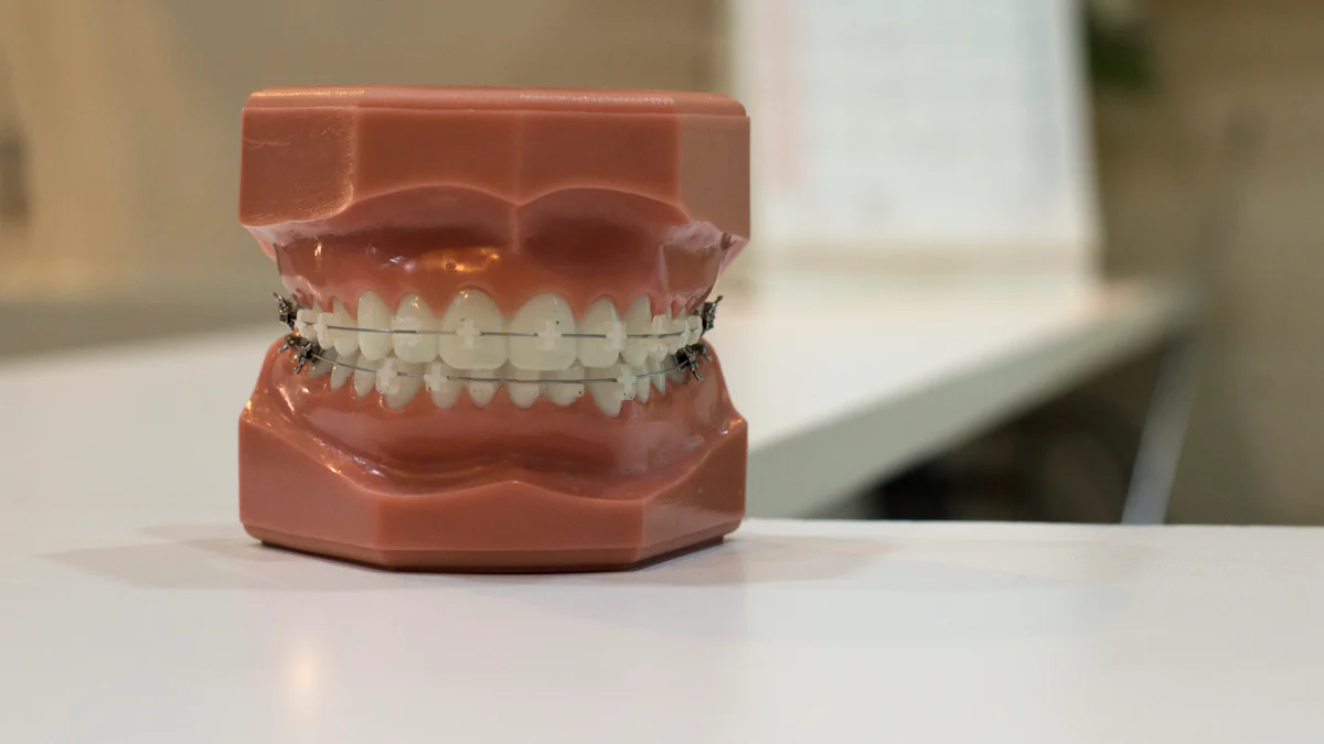 Why Self Ligating Brackets Transform Orthodontics