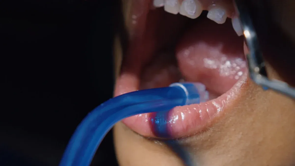 How Long Does FRYD Extracts THC Vape Stay in Saliva