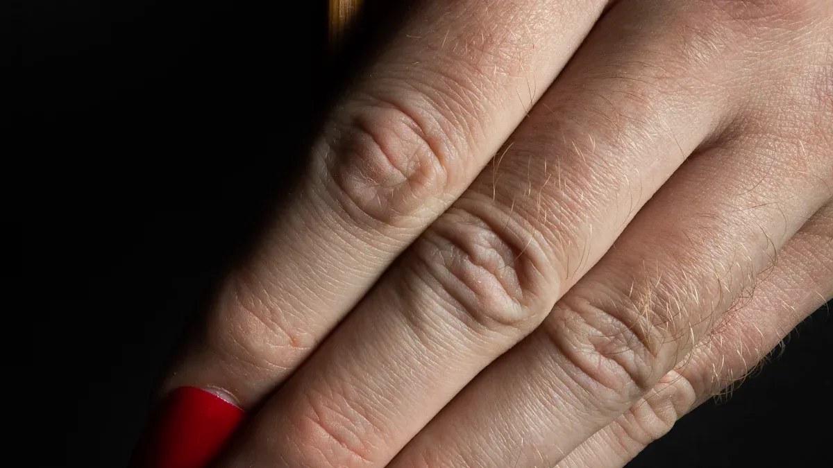 Rischi di una polimerizzazione errata: polimerizzazione insufficiente o eccessiva dello smalto gel