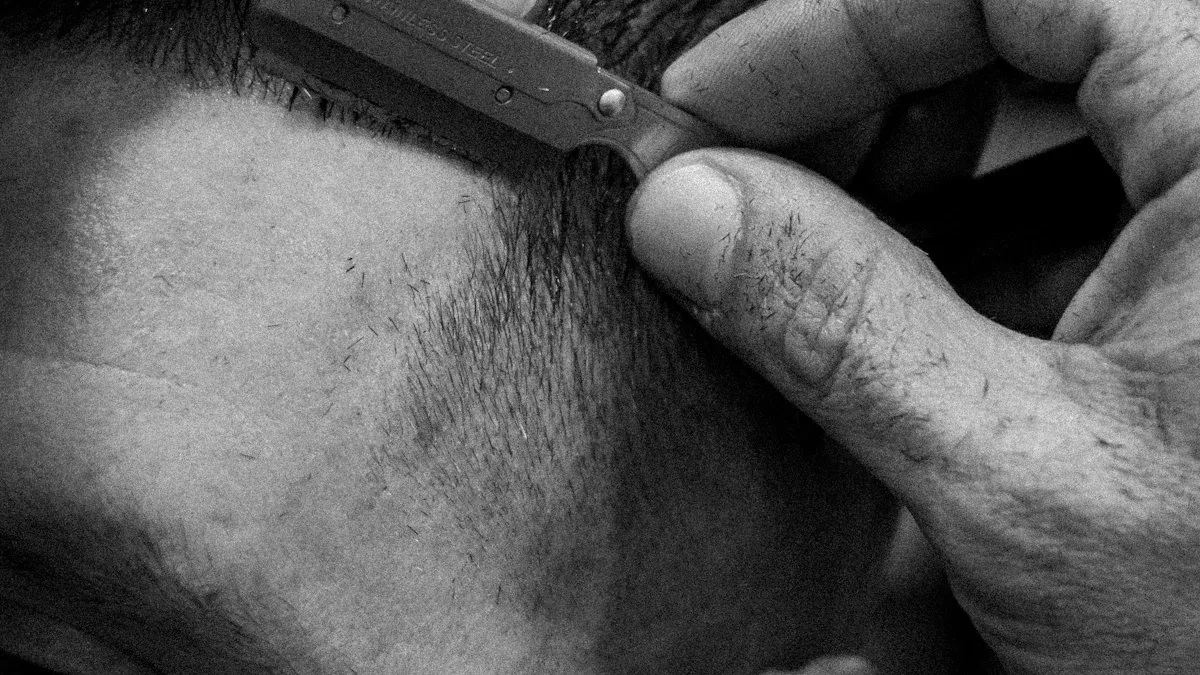 Managing Pearl Hairline and Receding Hairline