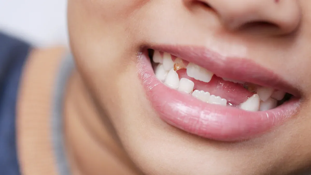 Milk Teeth to Permanent Teeth: A Filipino Parent'
                style=