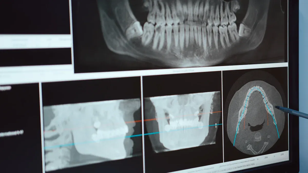 Cake X Ray Machine Functions