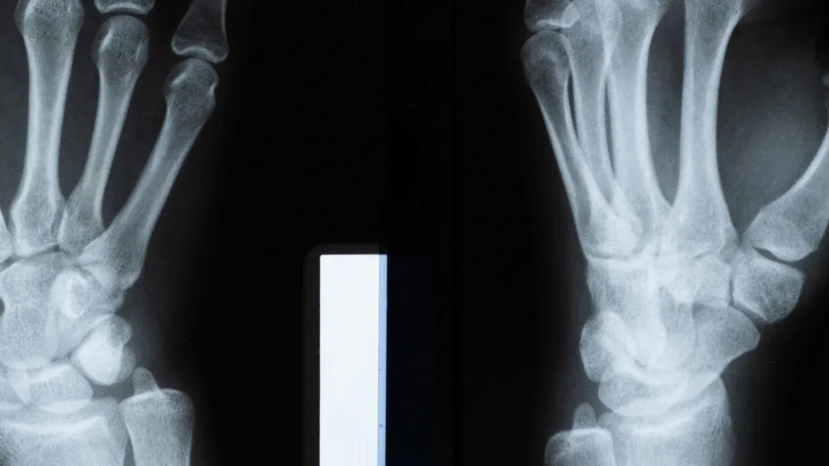 How Chocolate Bar X Ray Equipment Works