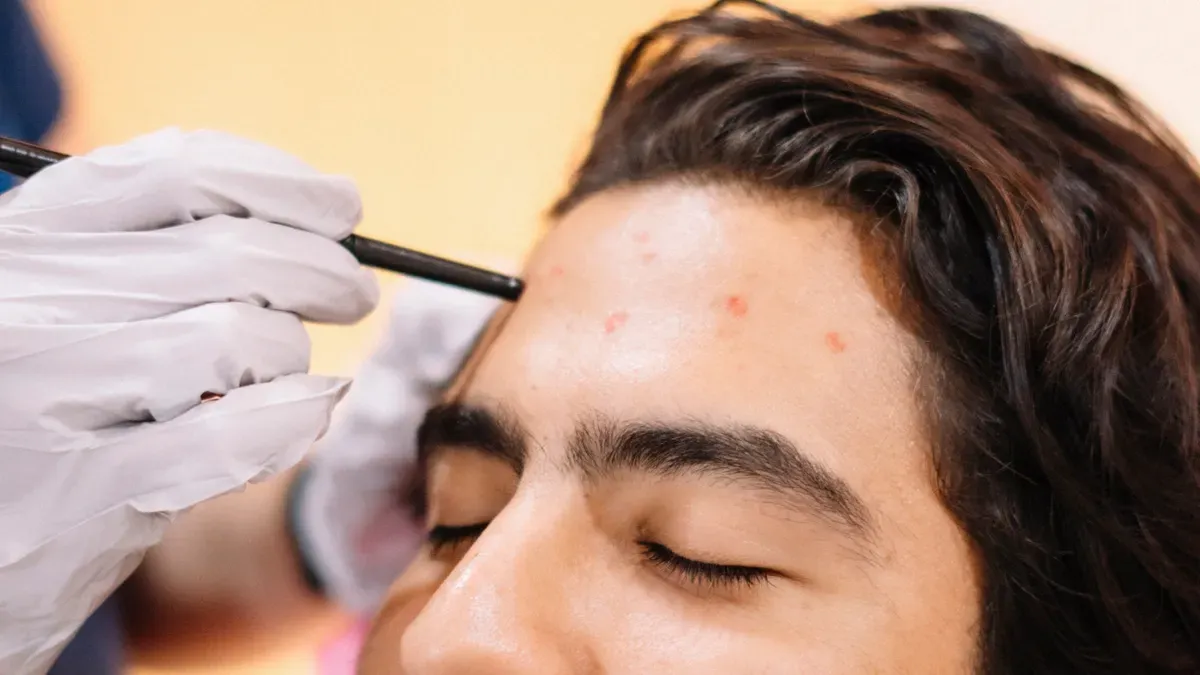 What is a hair transplant pen mainly used for?