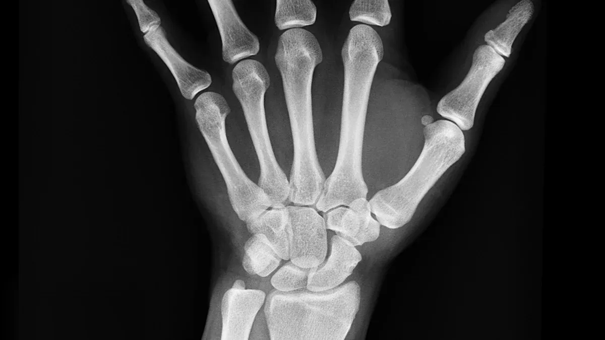 Radiopacity in Medical Devices