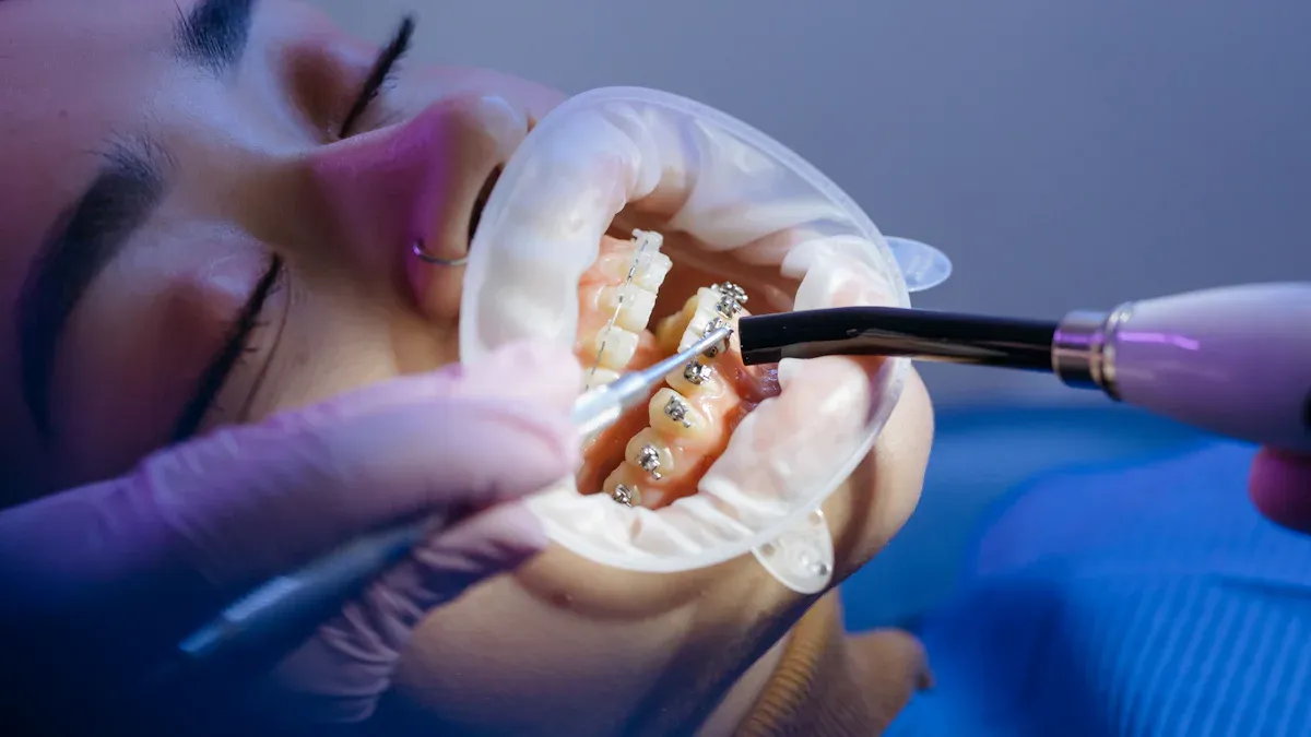 Metodele moderne de chirurgie orală