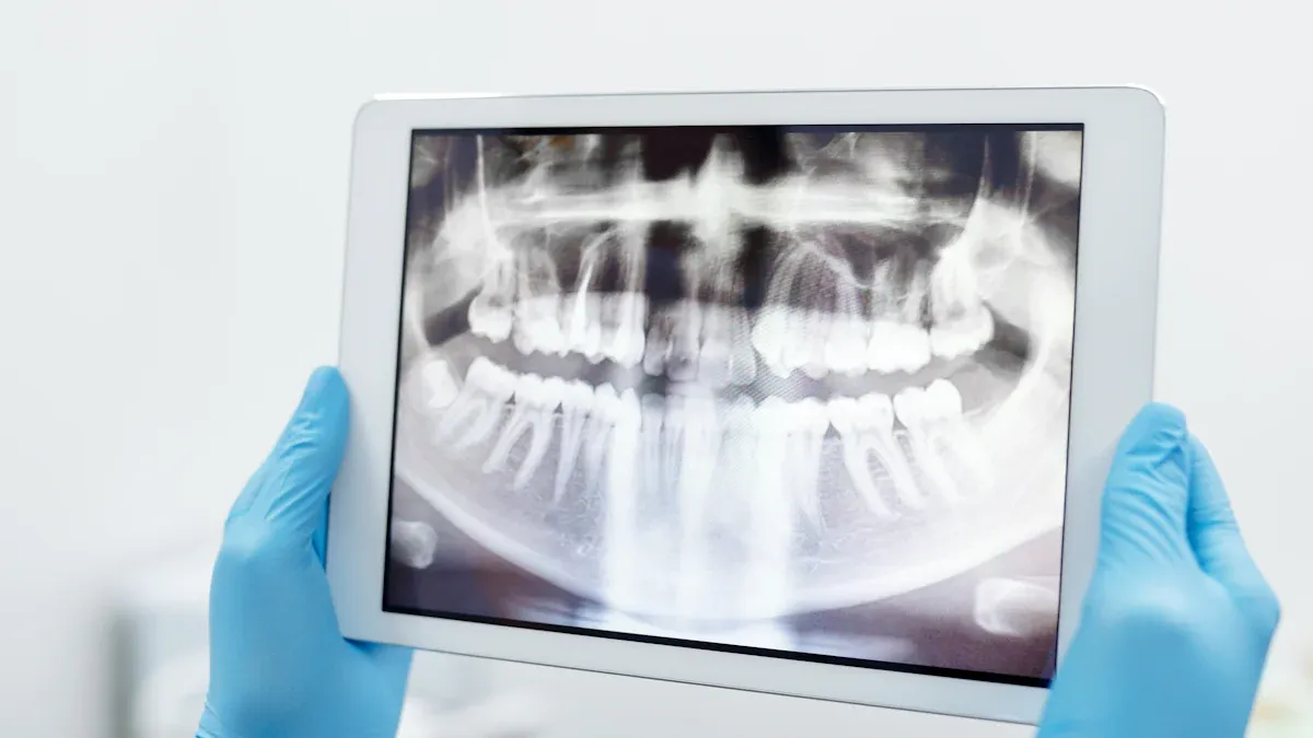 Tipuri de radiografii dentare