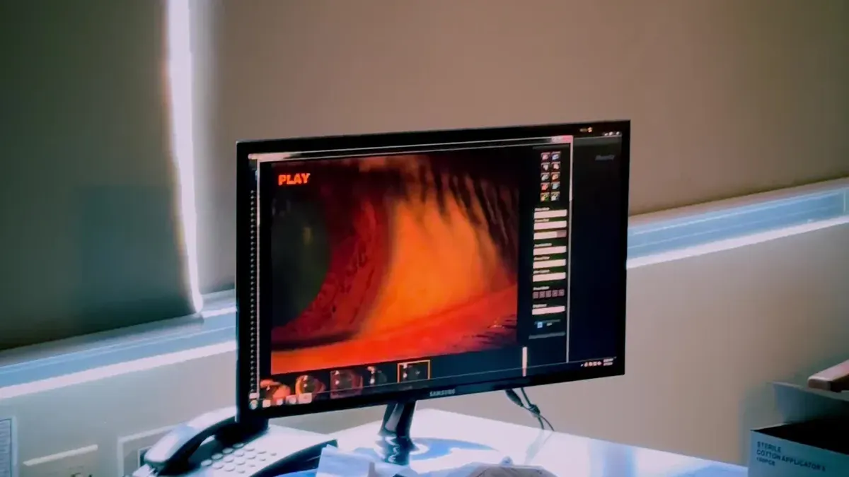 How to Prevent Shrinkage with Computer Vision