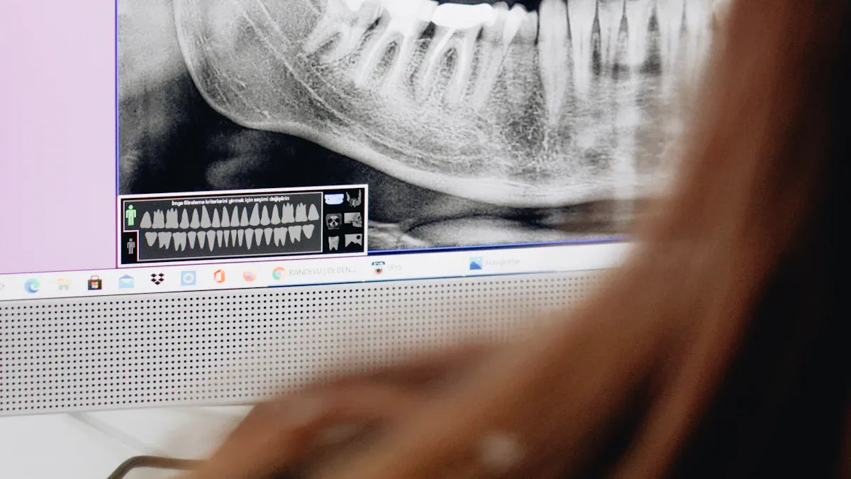 The role of X-ray in the surface mount technology (SMT) processing